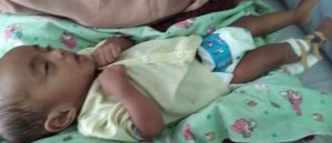Anak Gizi Buruk Dapat Bantuan Baznas dan Layanan RSUD Maspul
