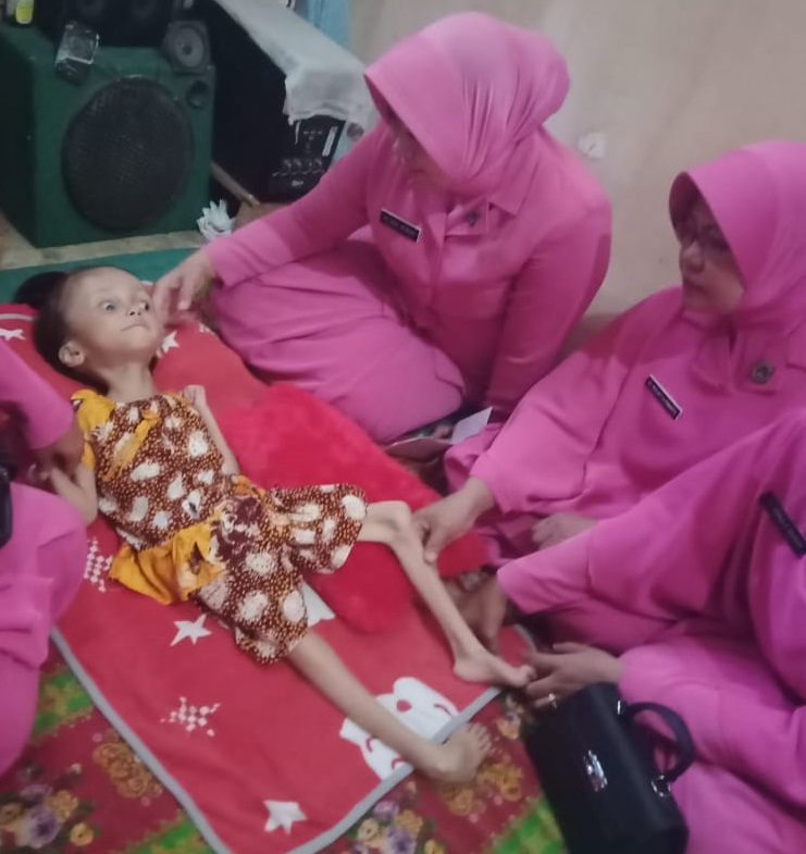 Ketua Bhayangkari Cabang Bantaeng Sambangi Pengidap Hidrocepalus