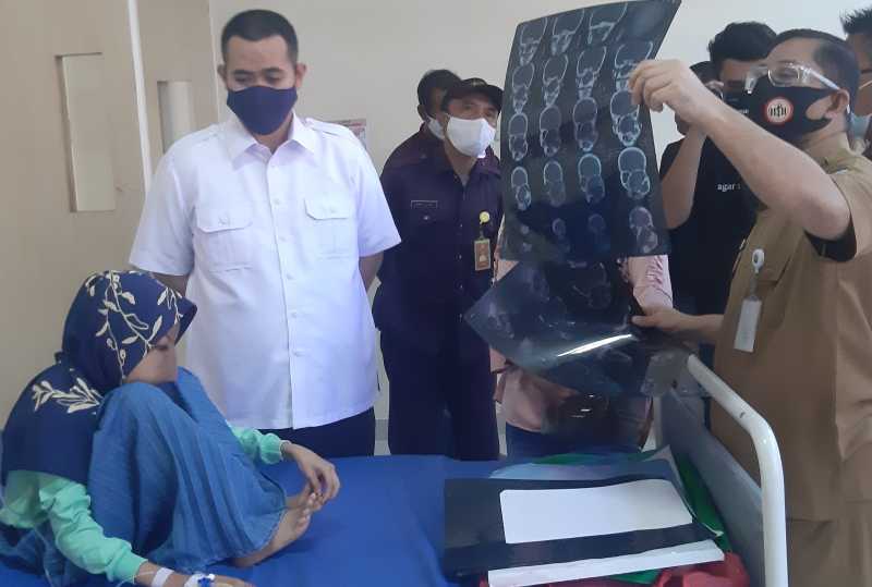 MYL Peduli, Kawal Pengobatan Bocah Diduga Tumor Tulang di Wajah