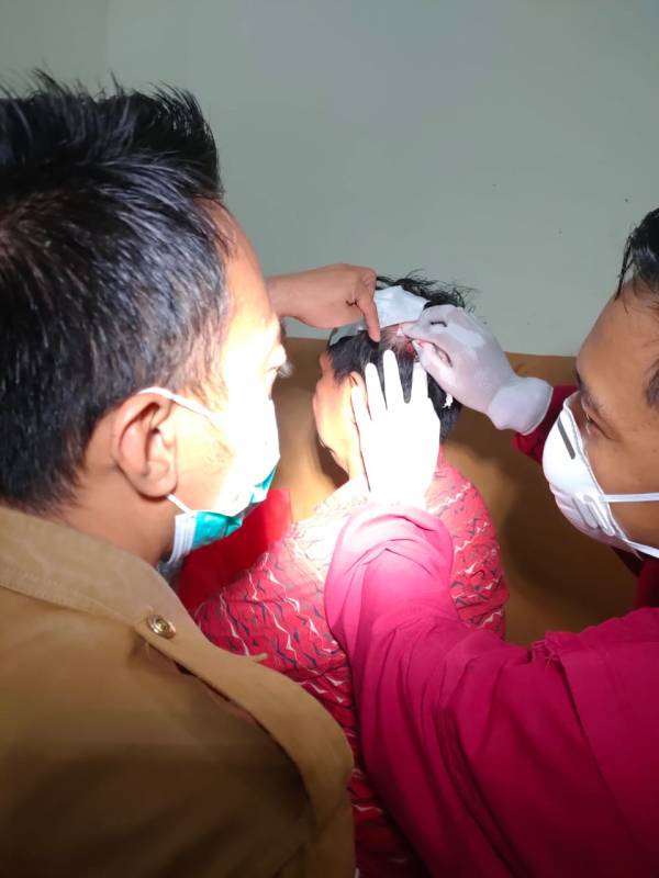 Legislator Takalar Bersitegang, Johan Nojeng Berdarah Kepalanya, Hantaman Doble Stick