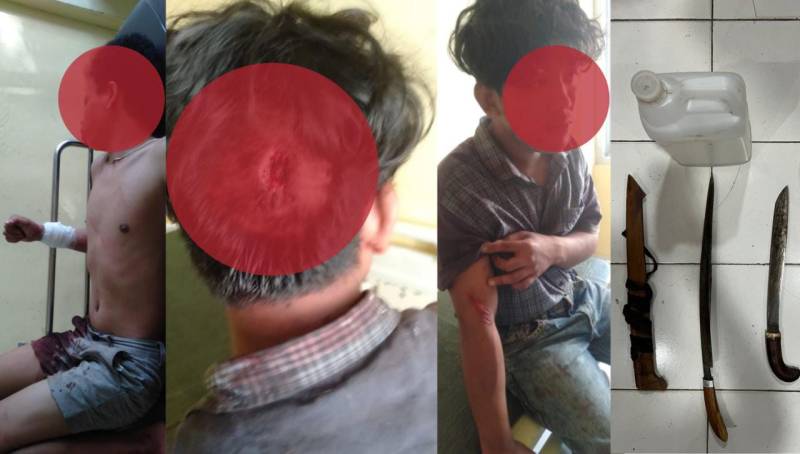 Akibat Minuman, Dua Warga Bontoborusu Baku Parang