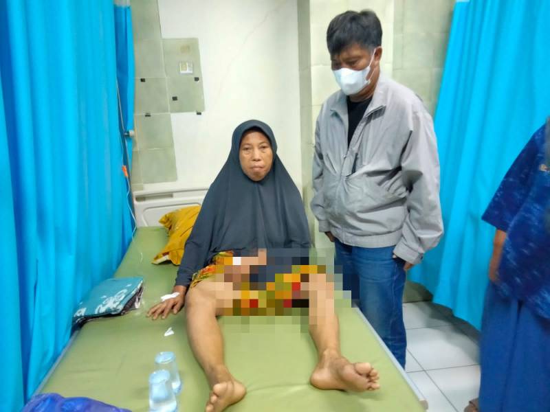 Peluru Nyasar Sasar Paha Ibu Rumah Tangga di Makassar 