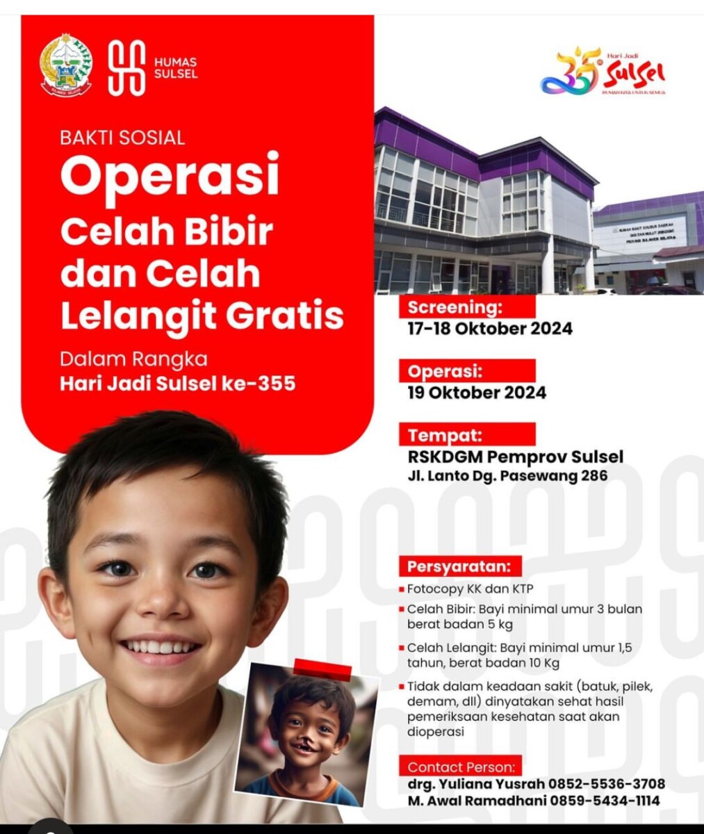 HUT ke-355 Sulsel, Pemprov Gelar Operasi Celah Bibir dan Celah Lelangit Gratis