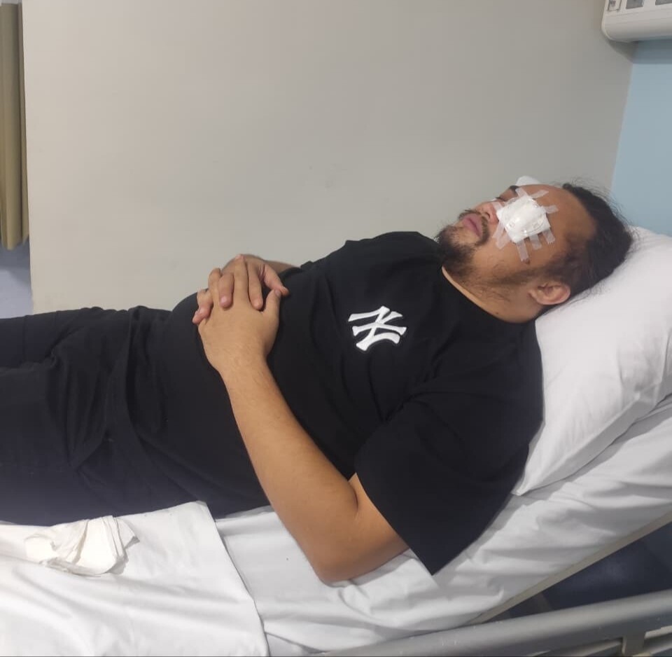 Amankan Tawuran, Anggota Polsek Bontoala Jadi Korban Petasan