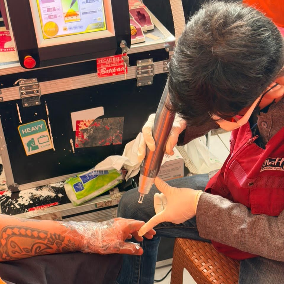 Semarak Hari Bakti Pemasyarakatan ke-62, Rutan Makassar Gelar Hapus Tato Gratis Bagi Warga Binaan Semarak Hari Bakti Pemasyarakatan ke-62, Rutan Makassar Gelar Hapus Tato Gratis Bagi Warga Binaan